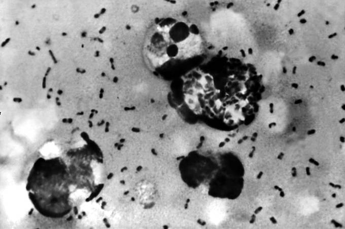(Centers for Disease Control and Prevention/Getty Images)